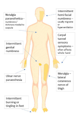 Benign Sensory Symptoms image