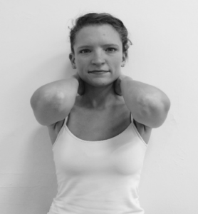 Radiotherapy exercise 6